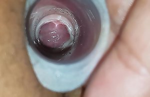 A shaft look at be imparted to murder wifes cervix